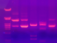 Electrophoresis gel